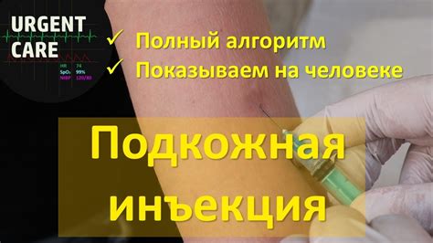 Альтернативные места инъекции мильгаммы