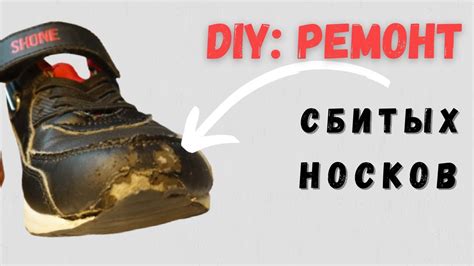 Методы восстановления детских сбитых носков