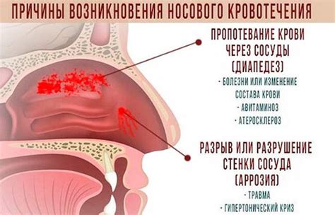 Приметология крови из носа