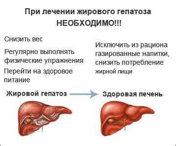Роль тюбажа в лечении жирового гепатоза: основные принципы и механизмы действия