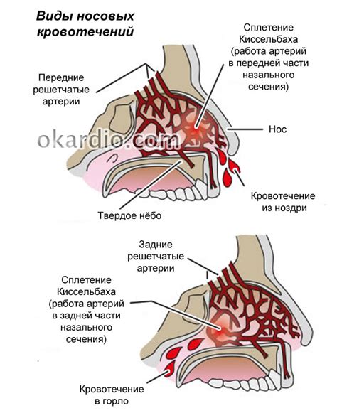 Смысл крови из носа